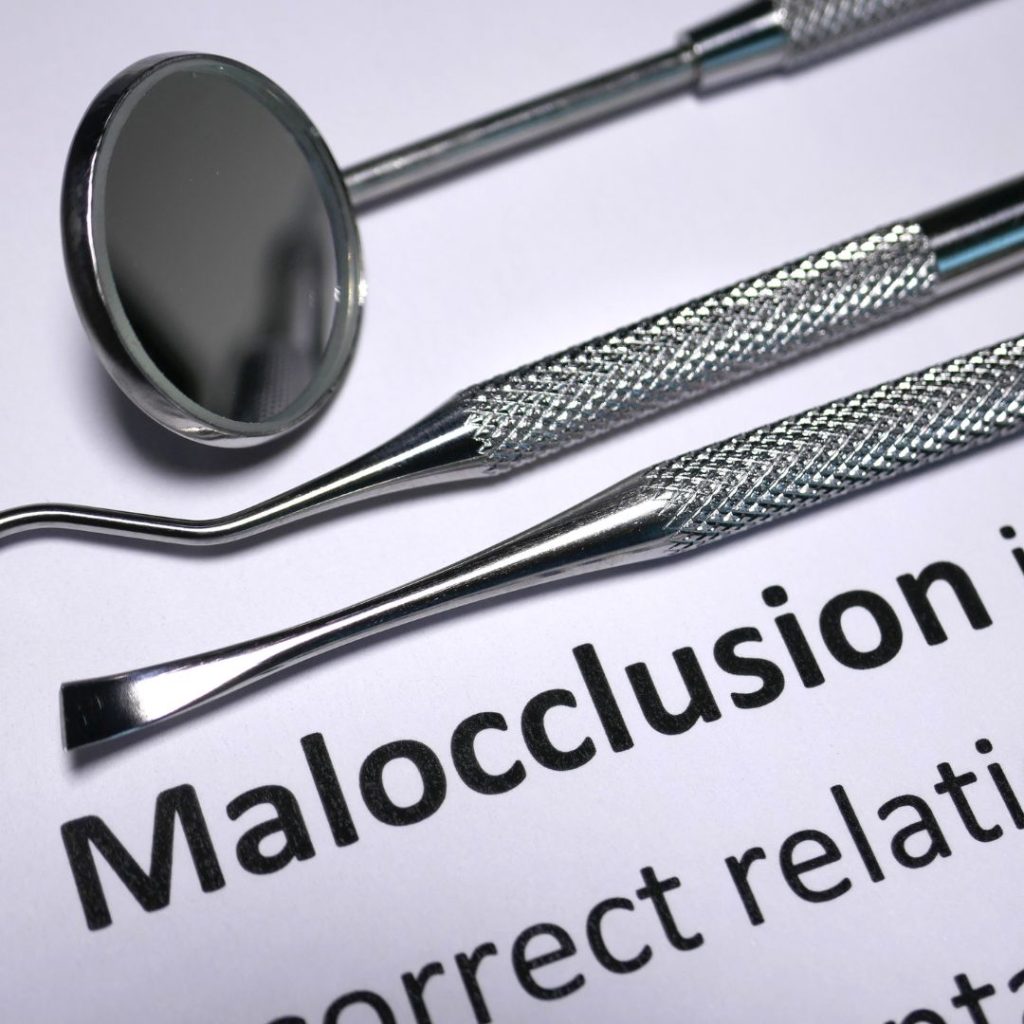 malocclusioni e allergie