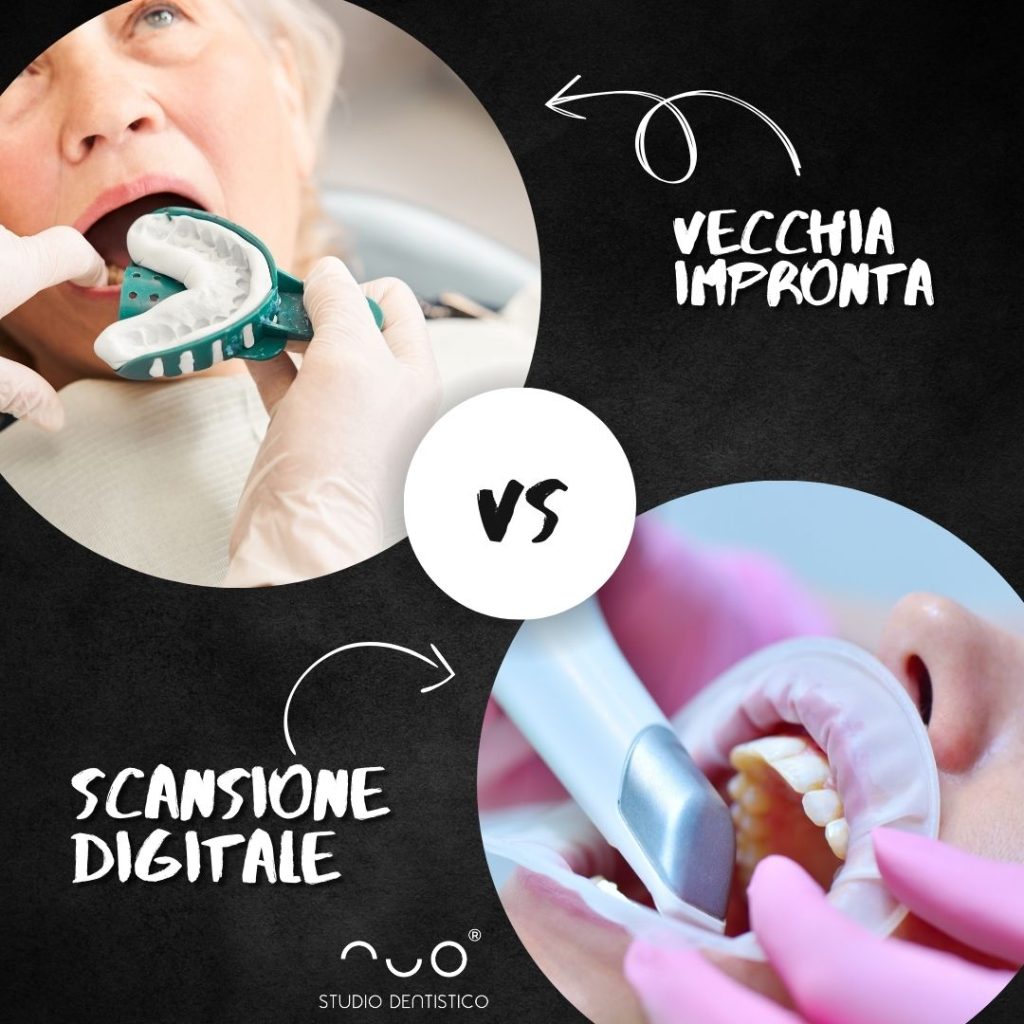 Dentista Acate e Scoglitti con Scansione 3d