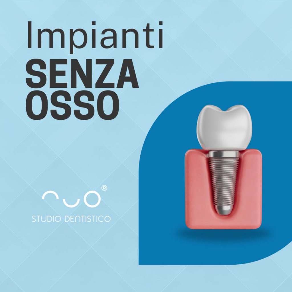Impianti senza Osso a Ragusa