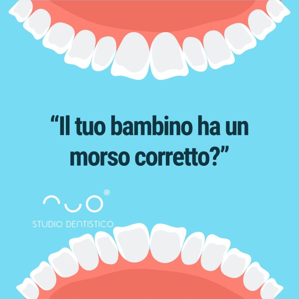 malocclusioni nei bambini di acate a ragusa