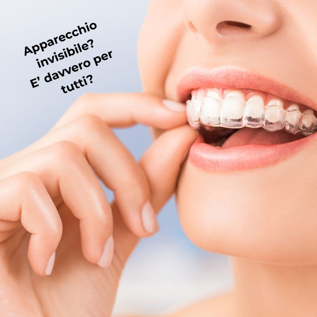 apparecchio invisibile per tutti?